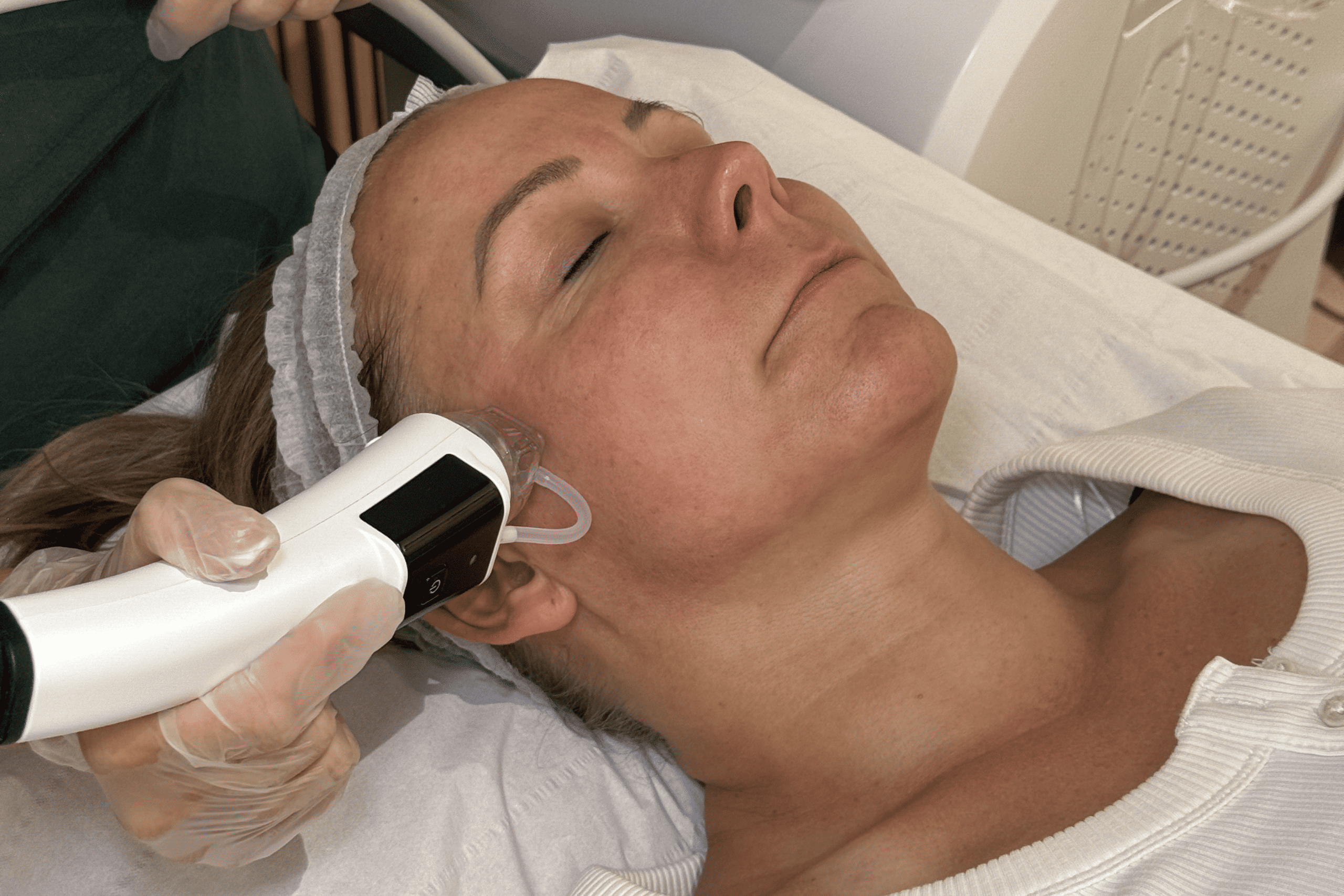 Dermaforce